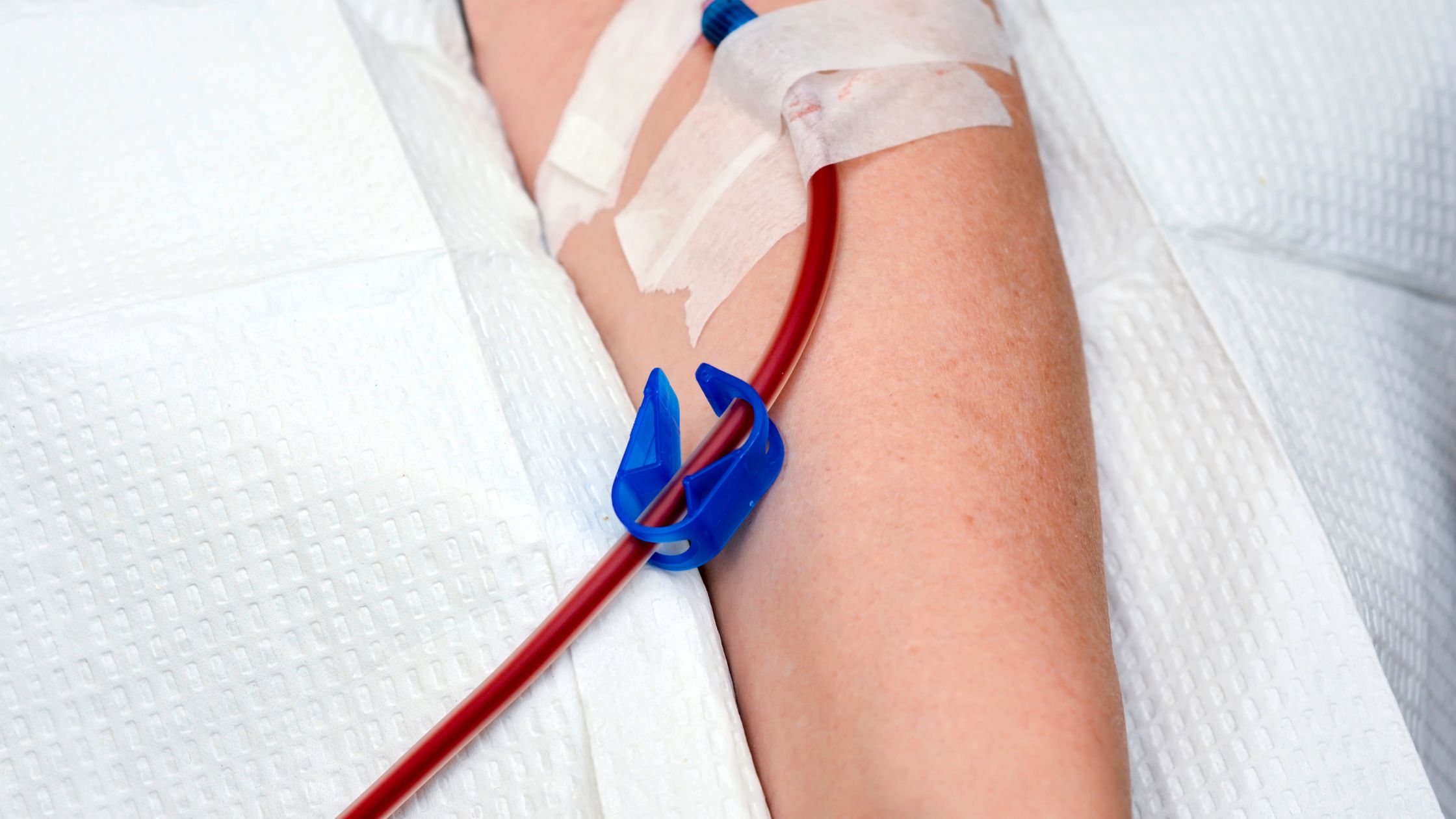 Ozone Blood Therapy